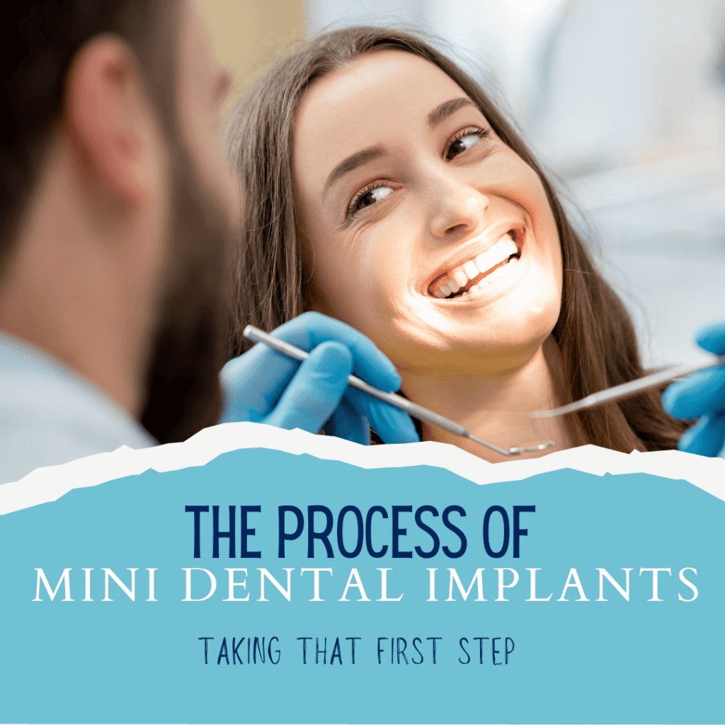 mini dental implants process header