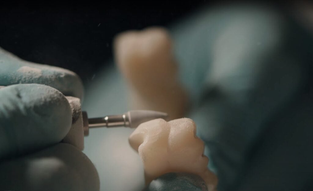 Dental lab work closeup