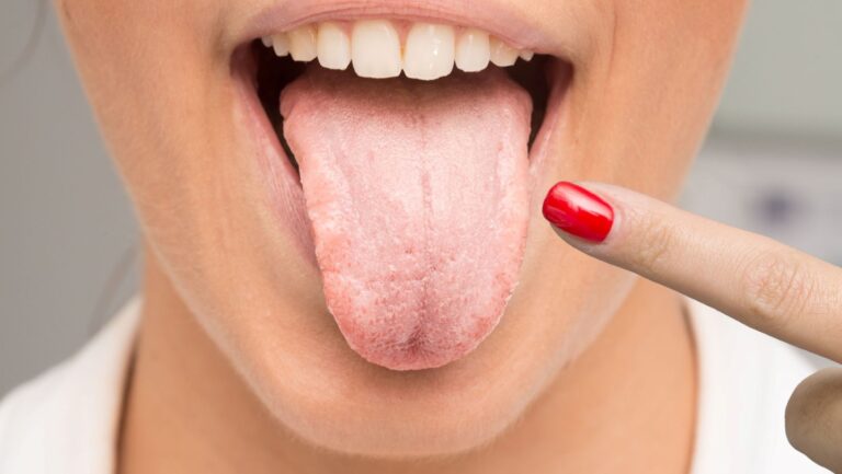 Taking Charge of Your Oral and Overall Health with Oral Saliva Testing