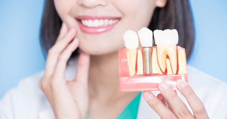 What Happens if My Dental Implant Has a Recall?